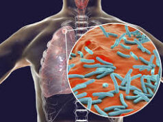 Goa leveraging PPPs to implement advanced technologies for TB elimination