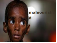 Poshan Tracker identifies 701 malnourished children in Goa; nutrition indicators improve