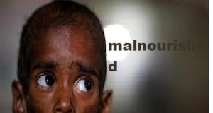 Poshan Tracker identifies 701 malnourished children in Goa; nutrition indicators improve