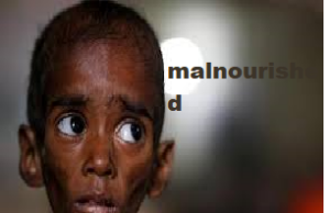 Poshan Tracker identifies 701 malnourished children in Goa; nutrition indicators improve